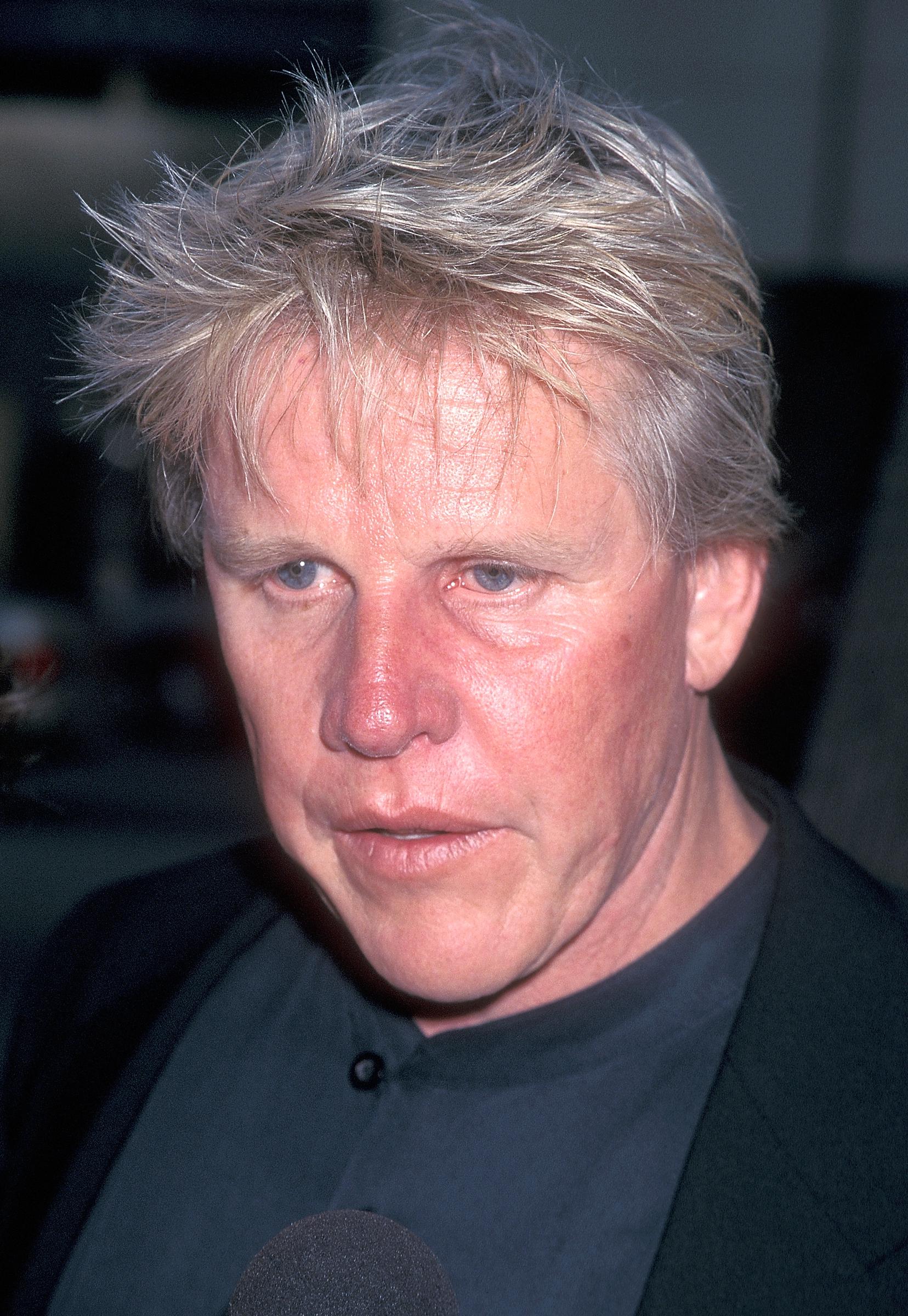 La enfermedad dio lugar a una intervención facial que acabó cambiando el aspecto físico de Gary Busey | Fuente: Getty Images