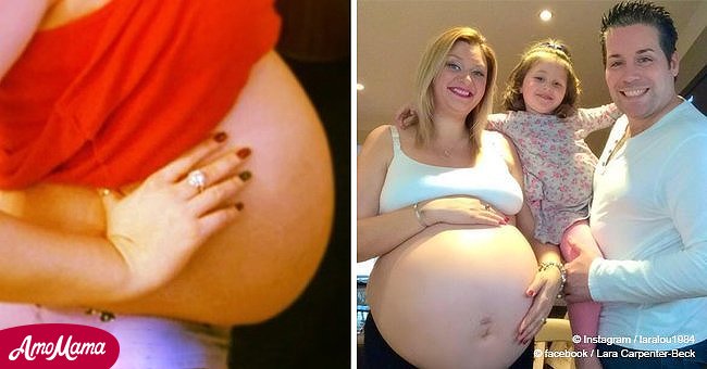 Mujer tenía barriga gigante a las 12 semanas de embarazo. Pero su vientre no dejó de crecer