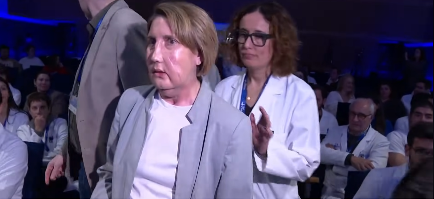 Carme, la mujer que se sometió a un trasplante facial en el Hospital Vall d'Hebron en Barcelona. | Fuente: YouTube/LibertadDigital