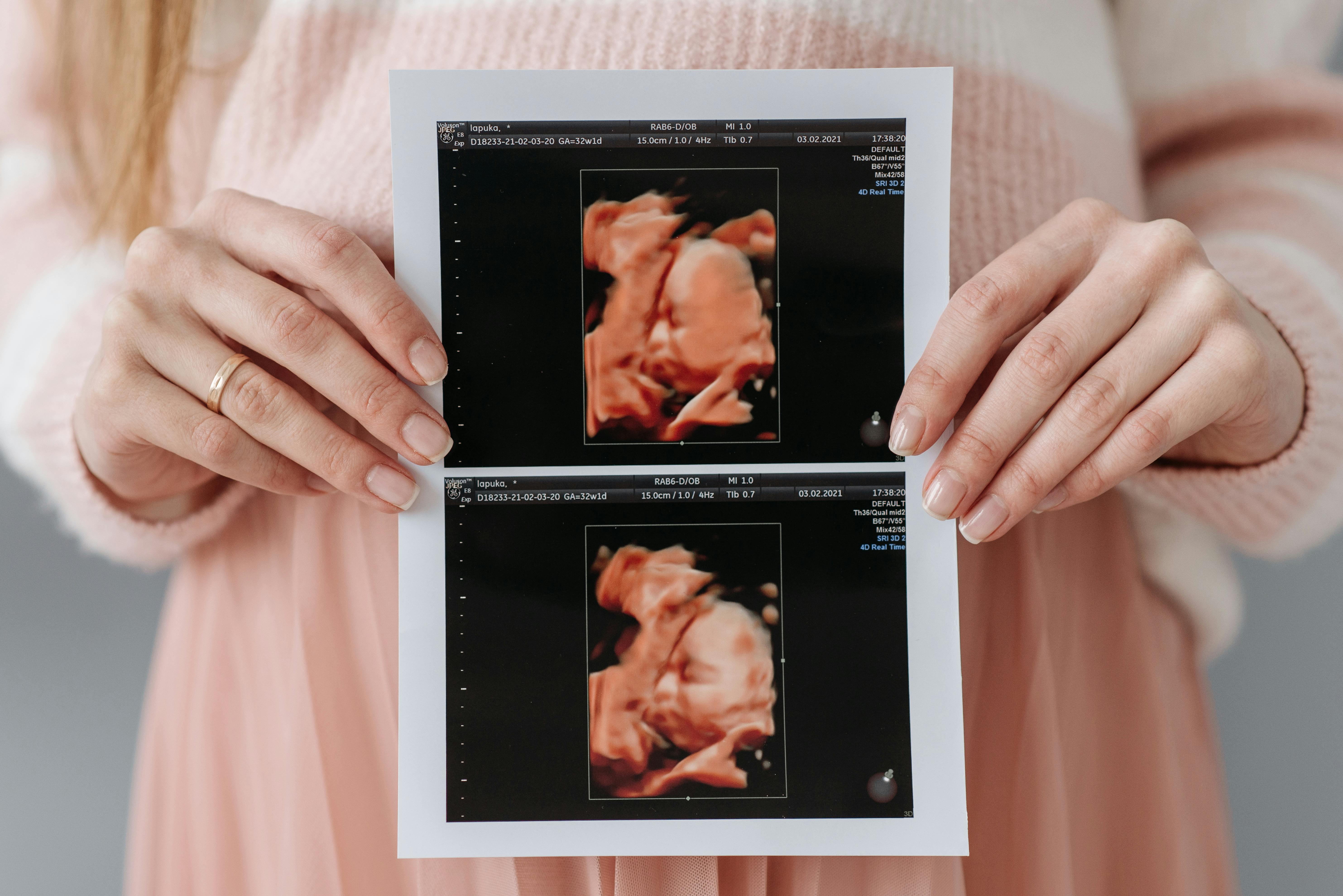 Imagen con fines ilustrativos | Foto: Pexels