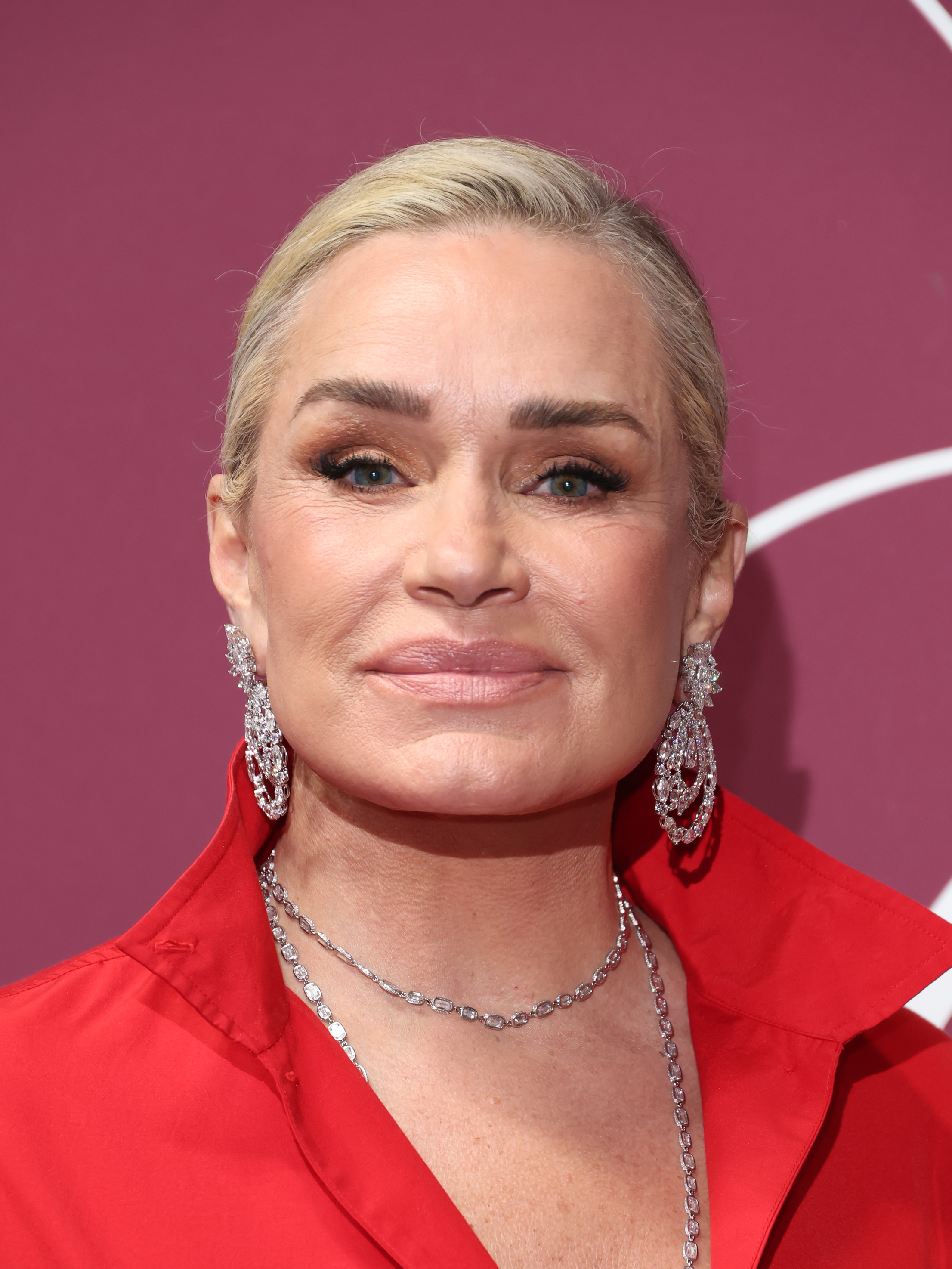 En 2026, Hadid llevaba ya años sin recurrir a los rellenos y al Botox de los que había hablado anteriormente. Describió esos cambios como parte de una evolución más amplia hacia dar prioridad a su salud y definir la belleza según sus propios criterios. | Fuente: Getty Images