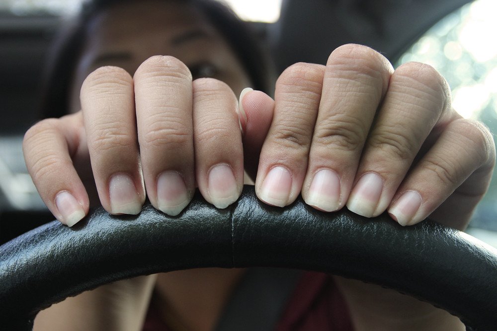 Manos con uñas quebradas sosteniendo volante. | Imagen: Flickr