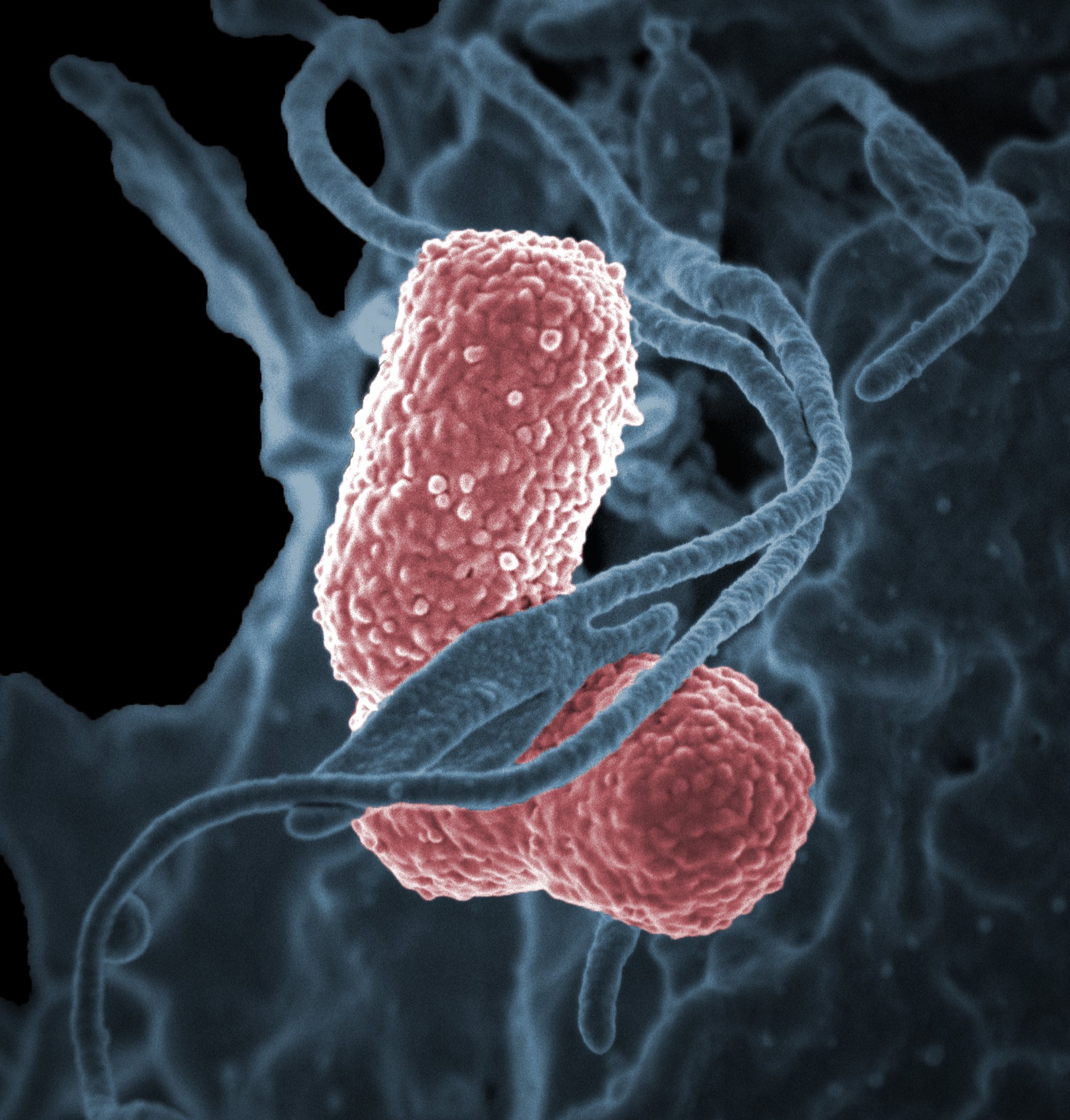 Bacteria Klebsiella pneumoniae. | Imagen: Flickr