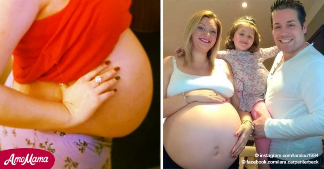 Mujer tenía gigante barriguita a las 12 semanas de embarazo. Creció y creció hasta el parto