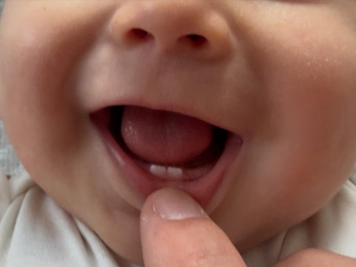Úrsula Corberó mostró el crecimiento de los dientes de su hijo Dante | Fuente: Instagram/ursulolita
