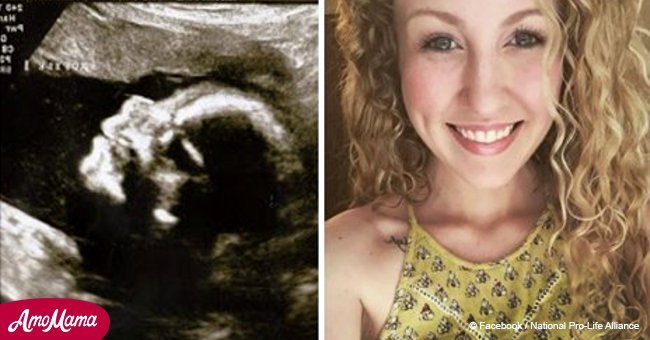 Mamá esperaba su ultrasonido de 18 semanas. Pero el doctor dijo que su bebé no tenía extremidades