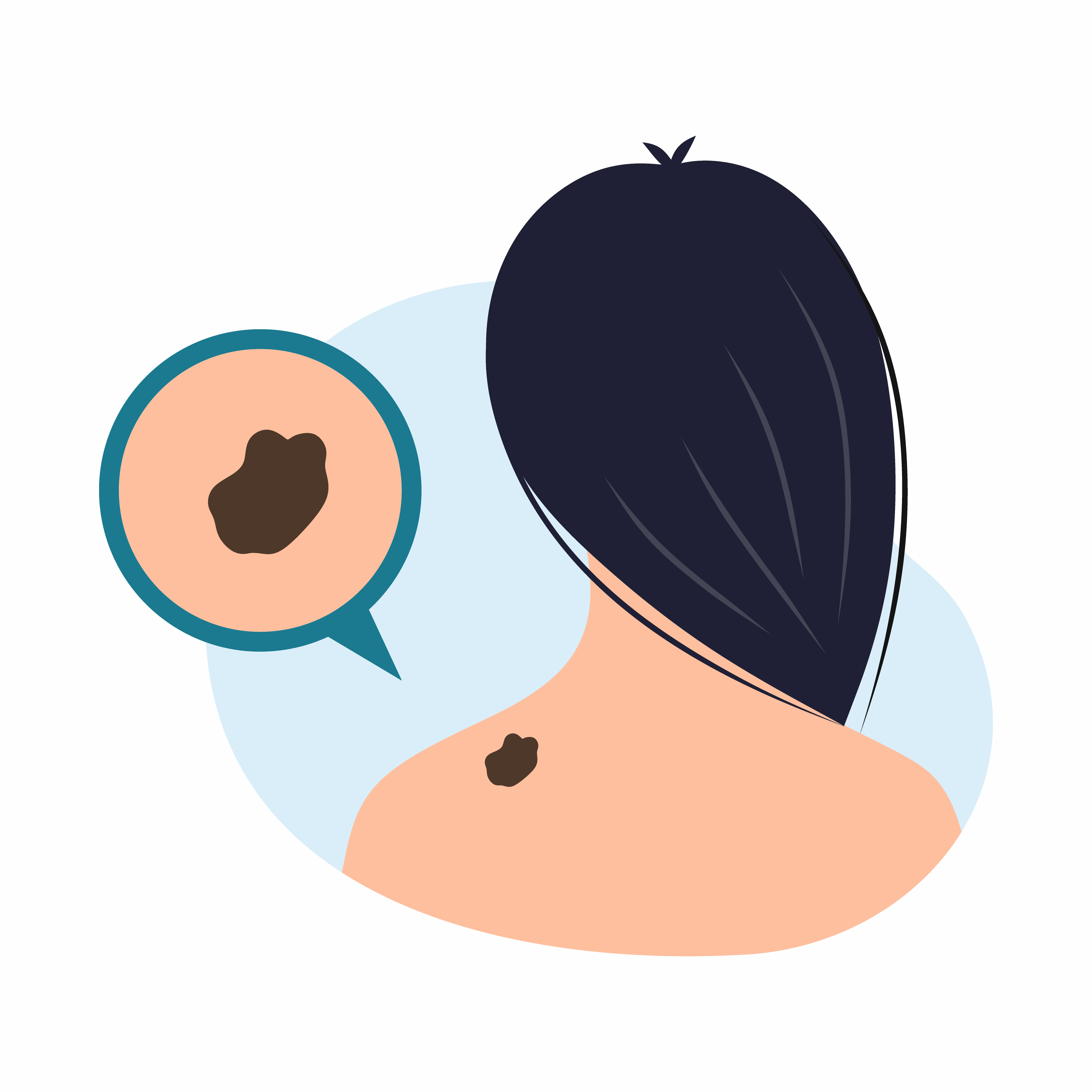 Mujer joven con una marca de nacimiento en el cuello, que pone de relieve la preocupación suscitada en el Día Mundial del Melanoma sobre la importancia de vigilar los cambios en la piel para detectar signos de cáncer | Fuente: Getty Images