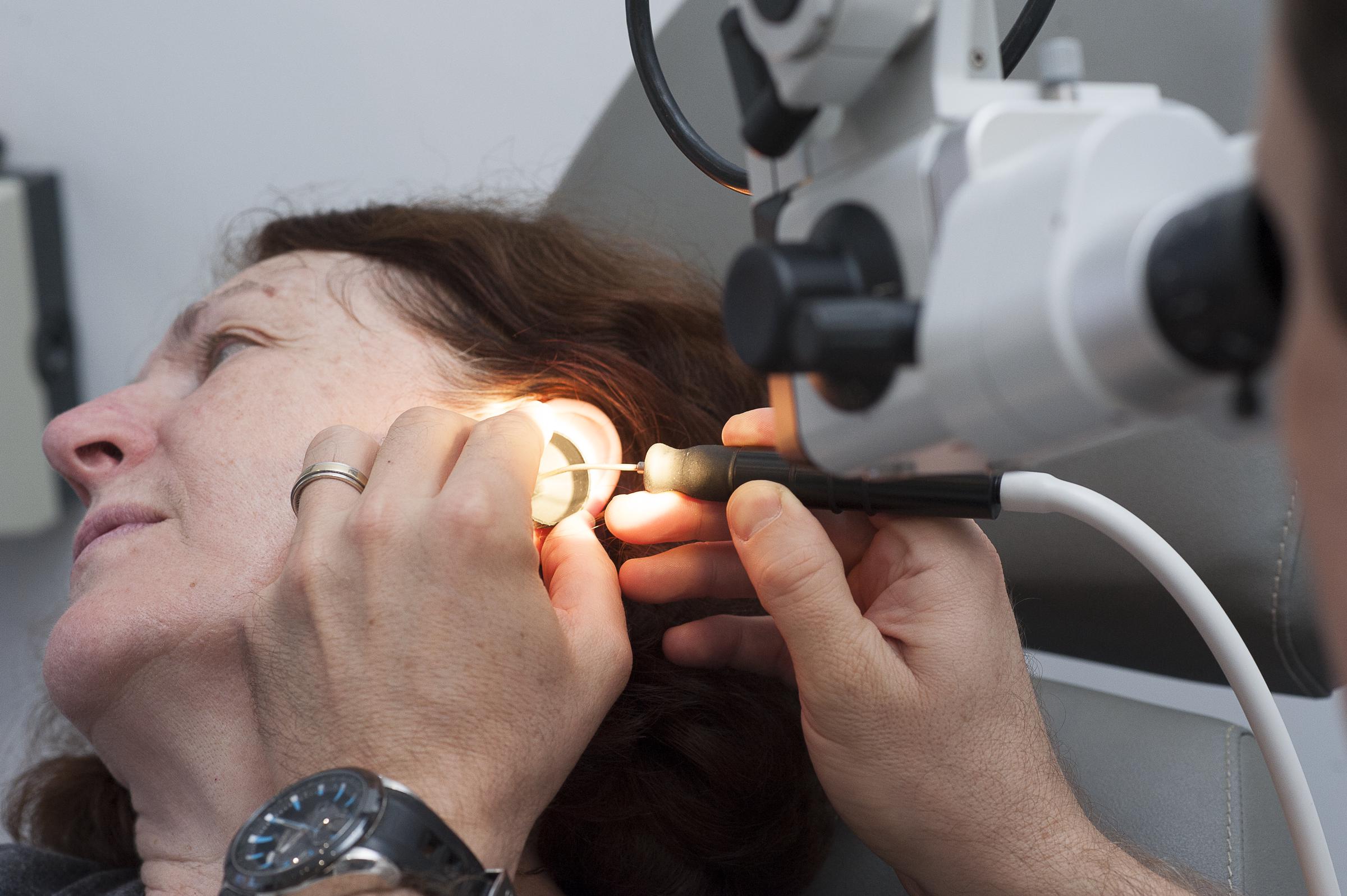 Examen detallado del oído realizado por un otorrinolaringólogo con herramientas de precisión y un microscopio quirúrgico | Fuente: Getty Images