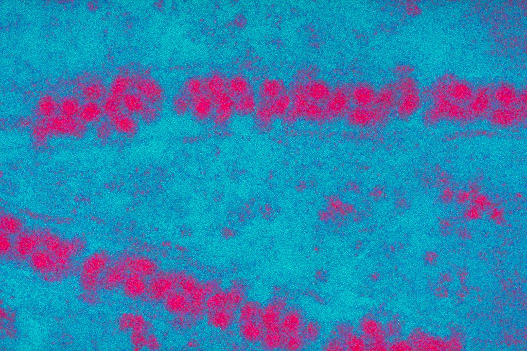 Imagen del virus de la encefalitis japonesa bajo el microscopio. | Imagen: Flickr