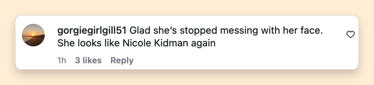 La aparición de Kidman también provocó reacciones que fueron más allá de su estilo, ya que algunos usuarios de las redes sociales compartieron sus opiniones sobre su look en general. Un usuario agregó: "Me alegro de que haya dejado de retocarse la cara. Vuelve a parecer Nicole Kidman". | Fuente: Instagram/entertainmenttonight