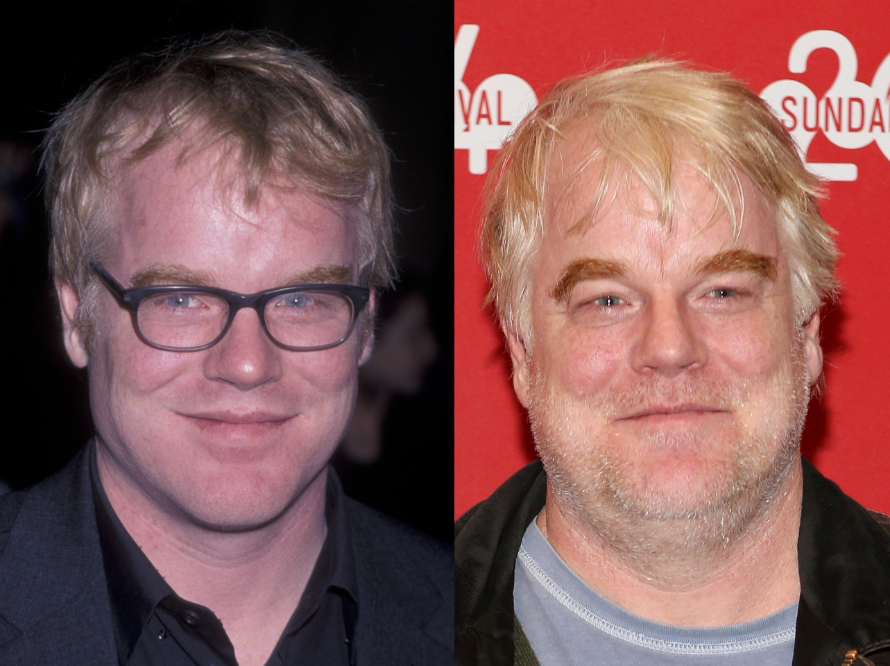 Philip Seymour Hoffman en 1999 | Philip Seymour Hoffman en 2014 | Fuente: Getty Images