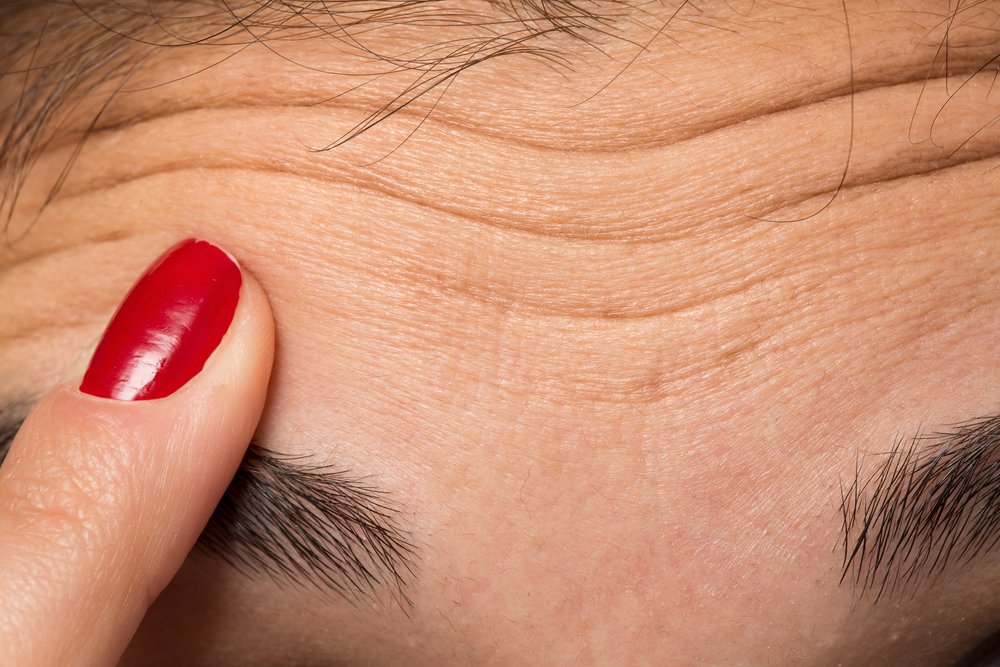 Mujer mostrando arrugas en su frente. | Foto: Shutterstock