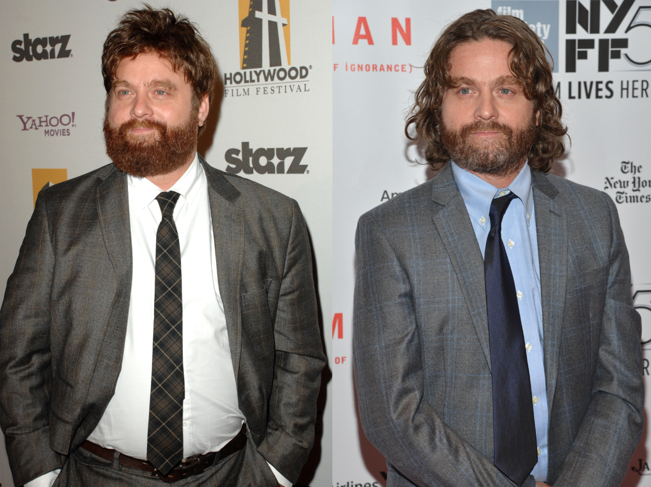 La transformación de Zach Galifianakis, antes y después de su impresionante pérdida de peso | Fuente: Getty Images