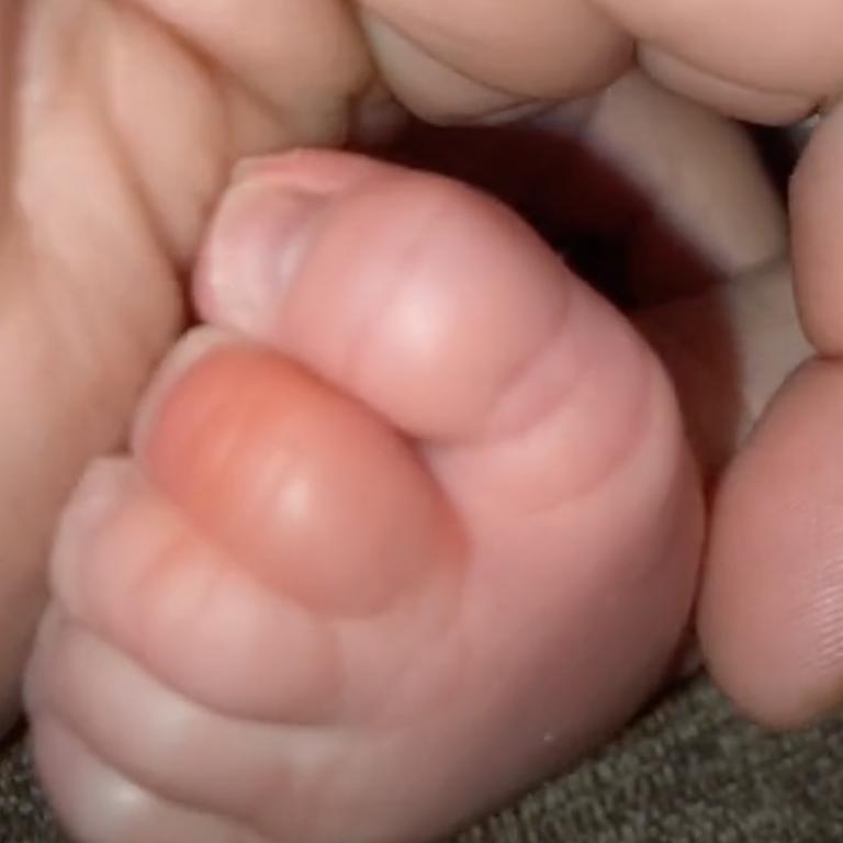 Los dedos del pie del bebé con el pelo enredado | Foto: Tiktok.com/riss_237