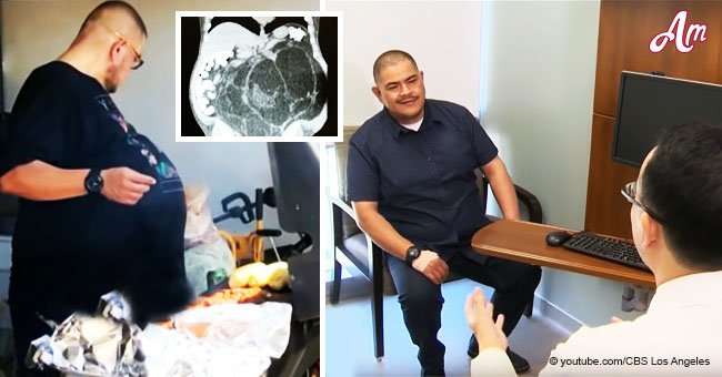 Hombre víctima de burlas por su 'barriga cervecera' descubre que en realidad es un tumor de 32kg