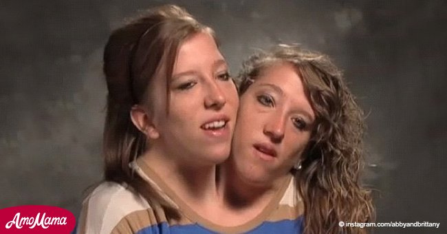 ¿Recuerdas a las gemelas siamesas Abby y Brittany Hensel? Ambas son adultas y hoy lucen diferentes