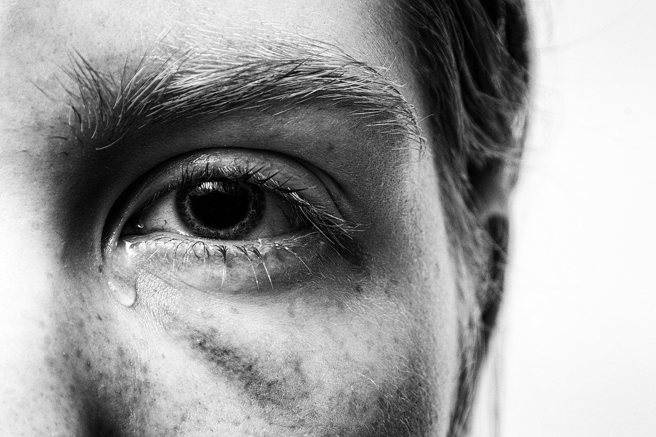 Persona con rostro magullado| Foto: Pixabay