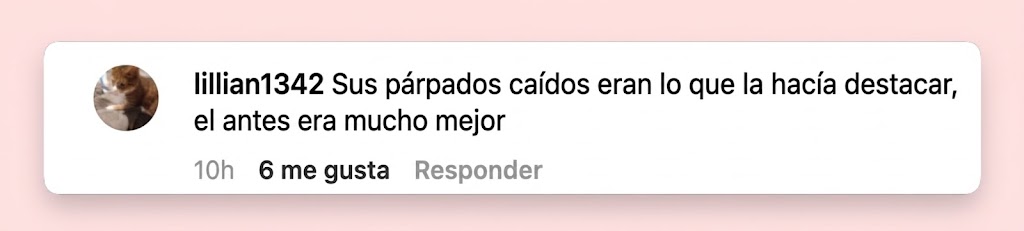 Una seguidora opinaba que los párpados caídos naturales de Lawrence habían sido uno de sus rasgos más característicos y le gustaba más cómo se veían en las fotos antiguas. | Fuente: Instagram/ @thecut