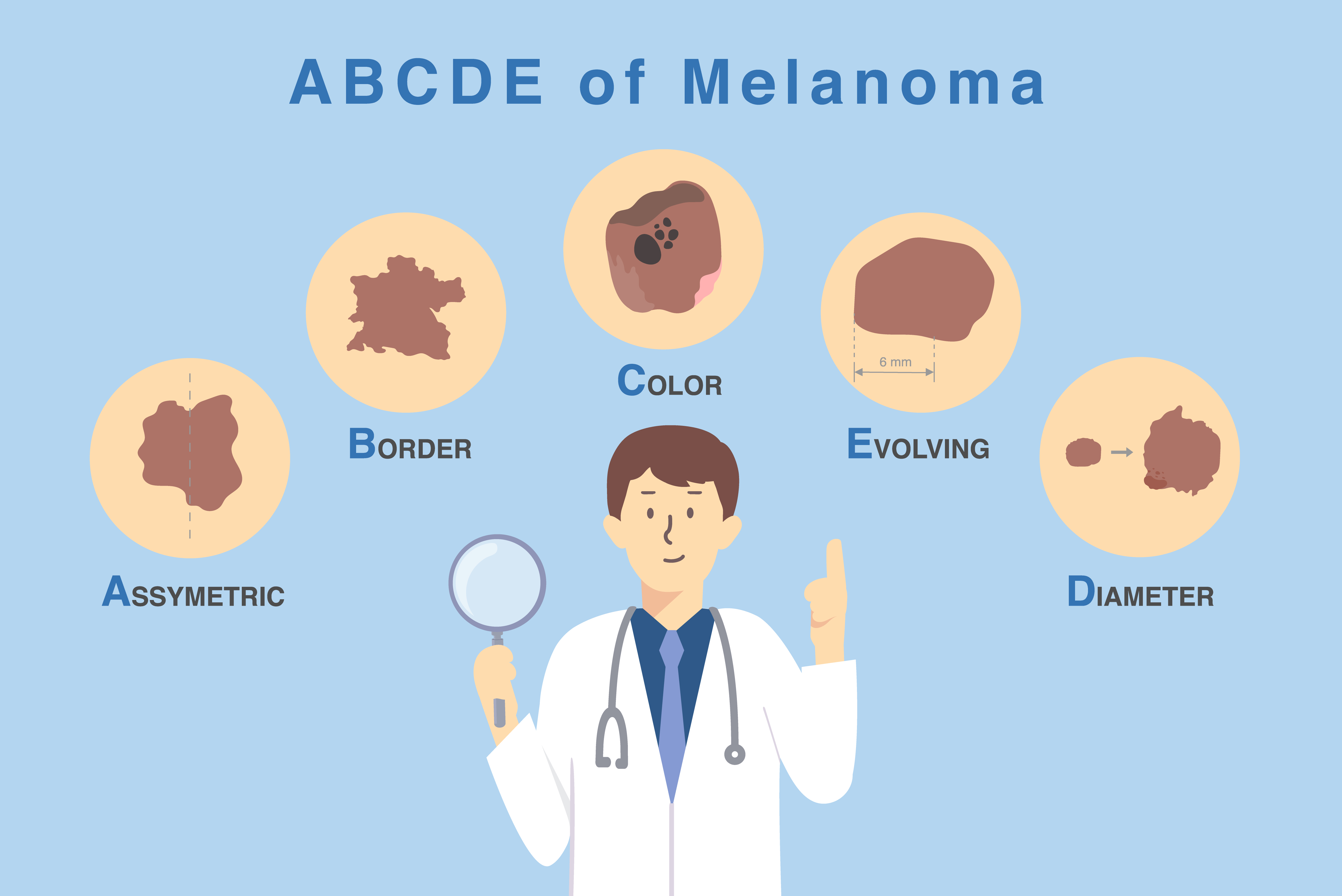 Médico sosteniendo una lupa sobre cinco características clave del daño cutáneo, demostrando el método ABCDE para diagnosticar y clasificar el melanoma | Fuente: Getty Images