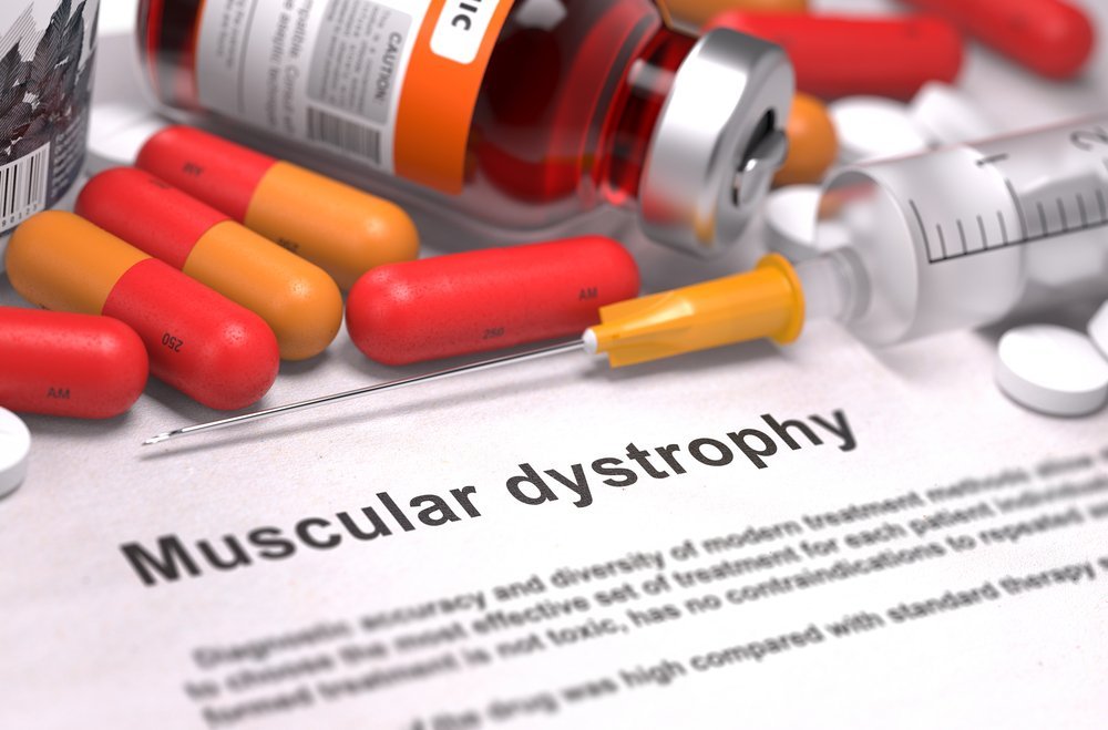 Diagnóstico impreso de distrofia muscular. Fuente: Shutterstock