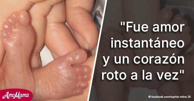 Mamá comparte desgarradoras fotos de su bebé de 22 semanas porque "los médicos la ignoraron"