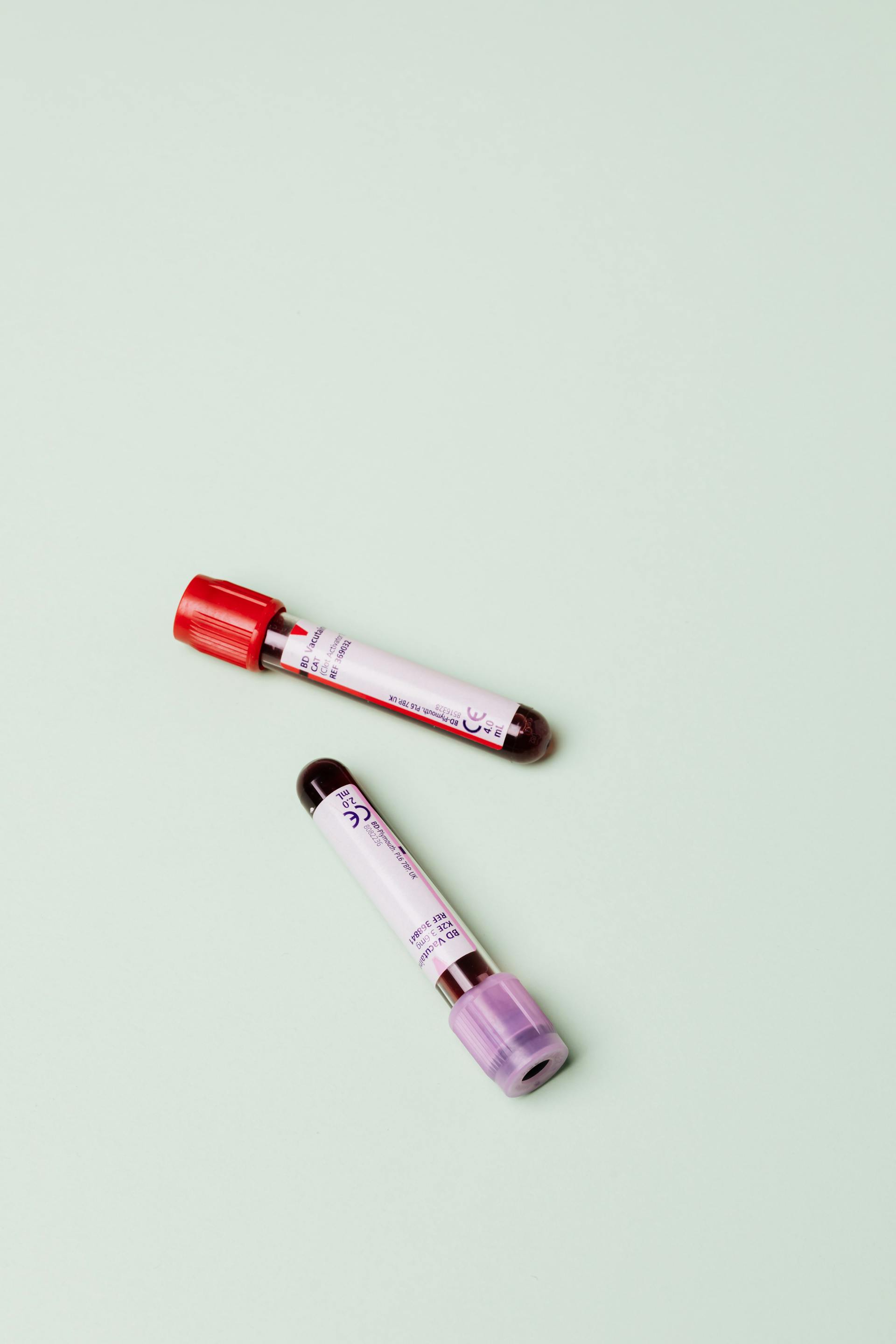 Dos viales de sangre | Foto: Pexels