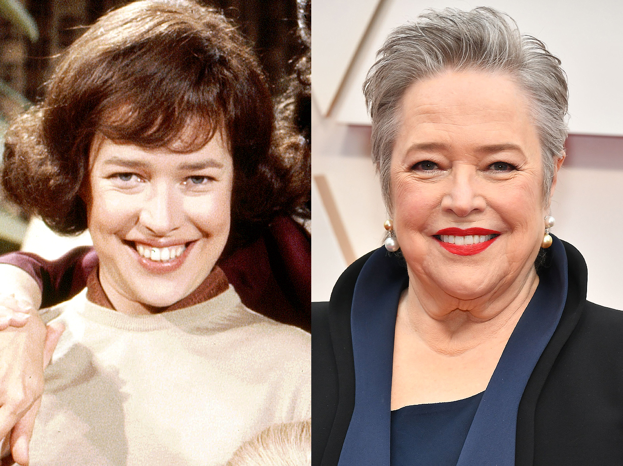 Kathy Bates en sus años jóvenes y en la actualidad. | Fuente: Getty Images