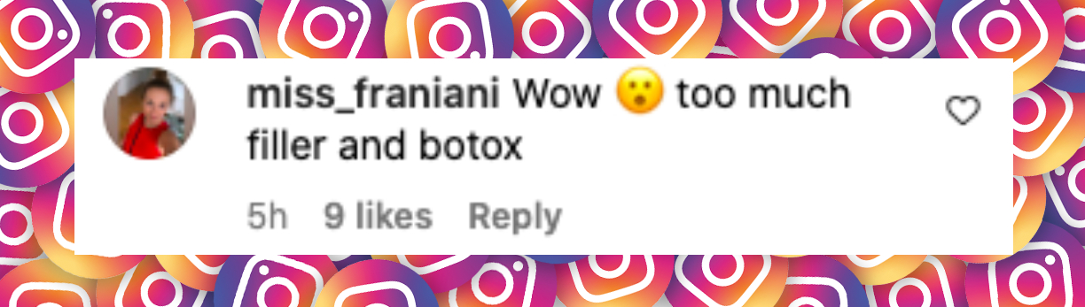 Comentario de un usuario sobre Nicole Kidman, publicado el 25 de octubre de 2024: "Demasiado botox y rellenos". | Fuente: Instagram/noticias