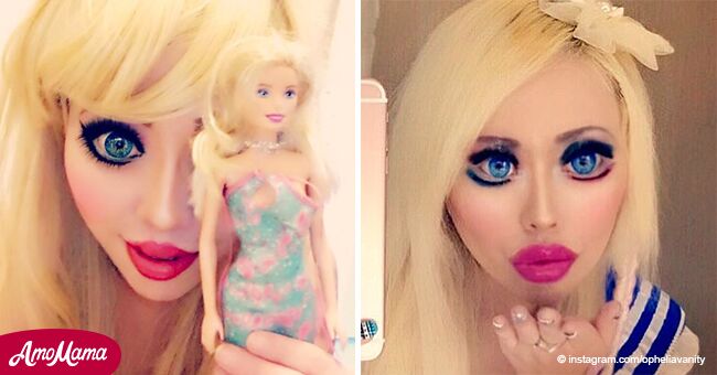 Mujer se somete a múltiples cirugías para lucir como una muñeca Barbie de la vida real