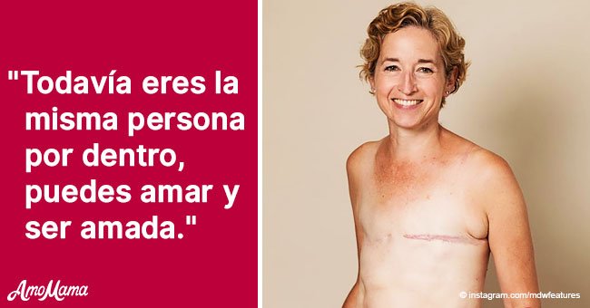 Valiente mamá muestra orgullosa sus cicatrices de mastectomía tras vencer al cáncer 3 veces