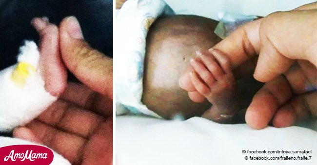 Bebé nació pesando 380 gramos y nadie esperaba que viviera, pero tuvo una increíble recuperación