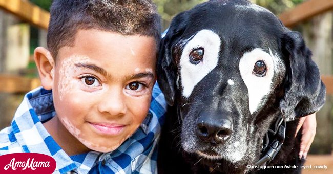 Cómo un niño con una afección de la piel encontró confort en un perro con la misma enfermedad