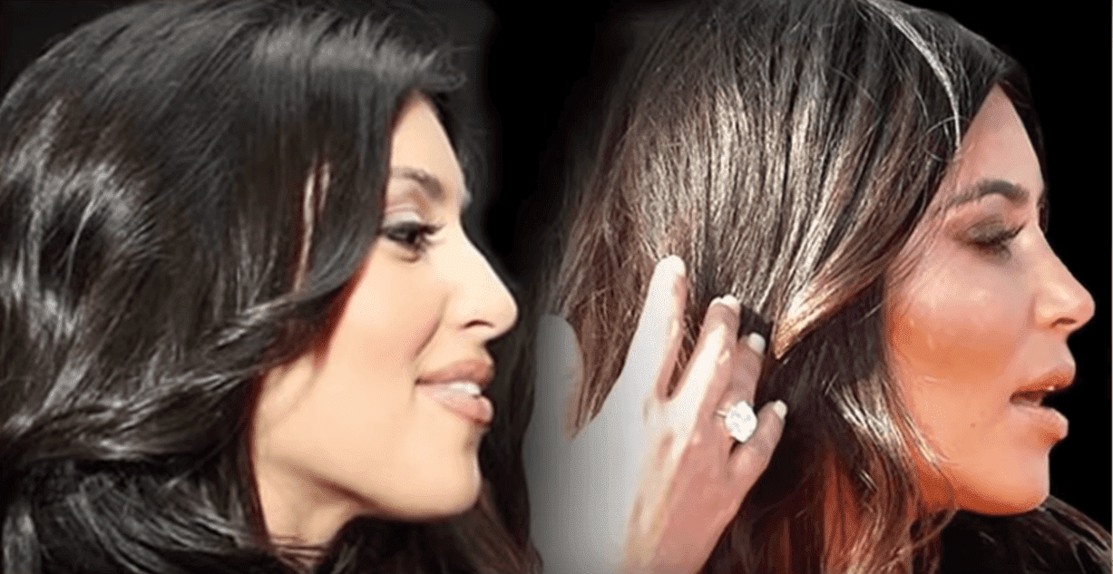 Fotos de perfil de Kim Kardashian, antes y después de sus retoques estéticos en el rostro. | Foto: Youtube / BellezaCreada