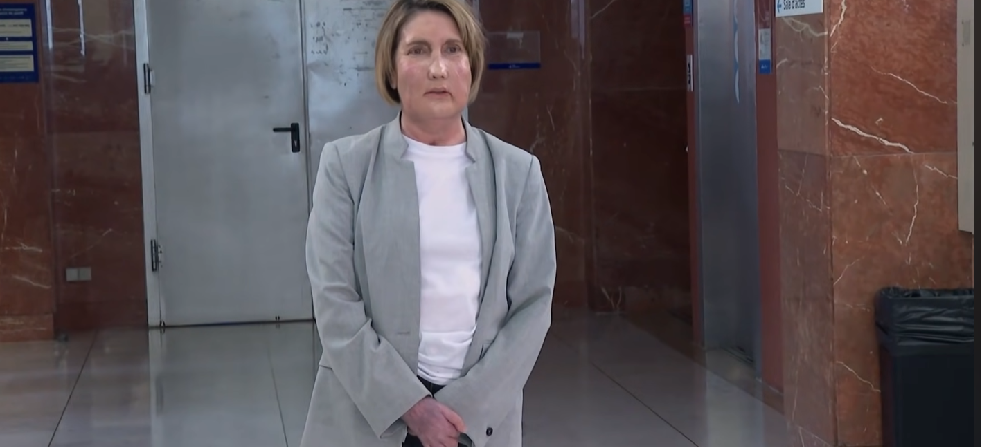 Carme, la mujer que se sometió a un trasplante facial en el Hospital Vall d'Hebron en Barcelona. | Fuente: YouTube/LibertadDigital