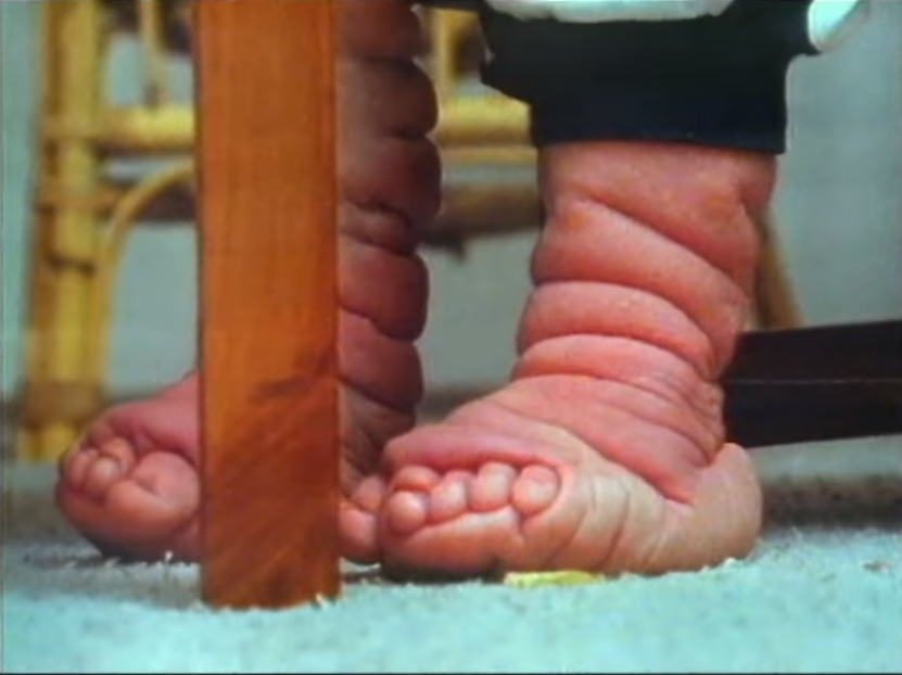 Un primer plano de las piernas y pies arrugados de Tomm Tennent. | Foto: YouTube.com/60 Minutes Australia