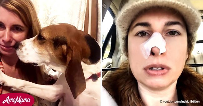 Perro constantemente olfatea la nariz de su dueña. Luego, un médico prueba que salvó la vida de la mujer 