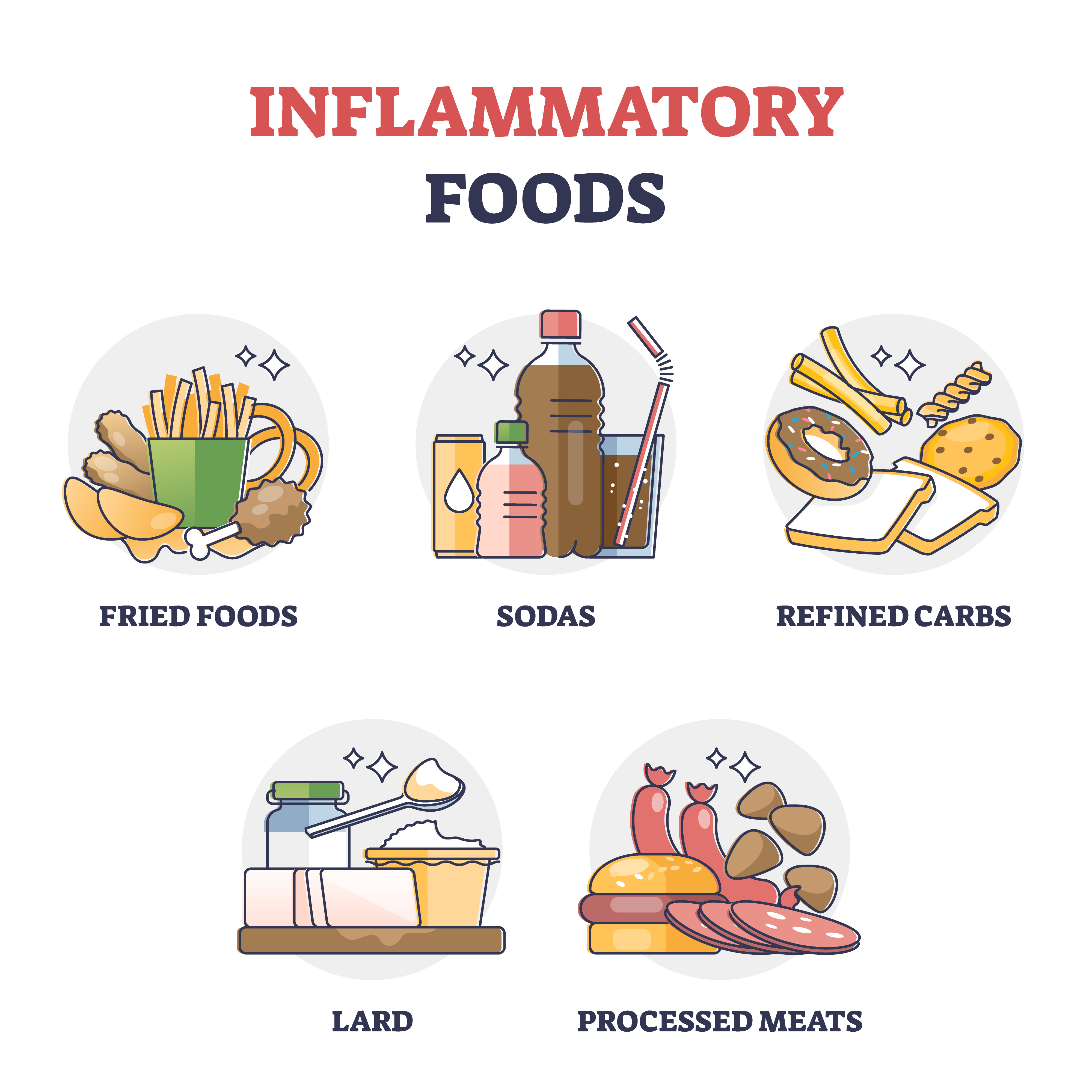 Un gráfico que muestra los alimentos inflamatorios | Fuente: Getty Images