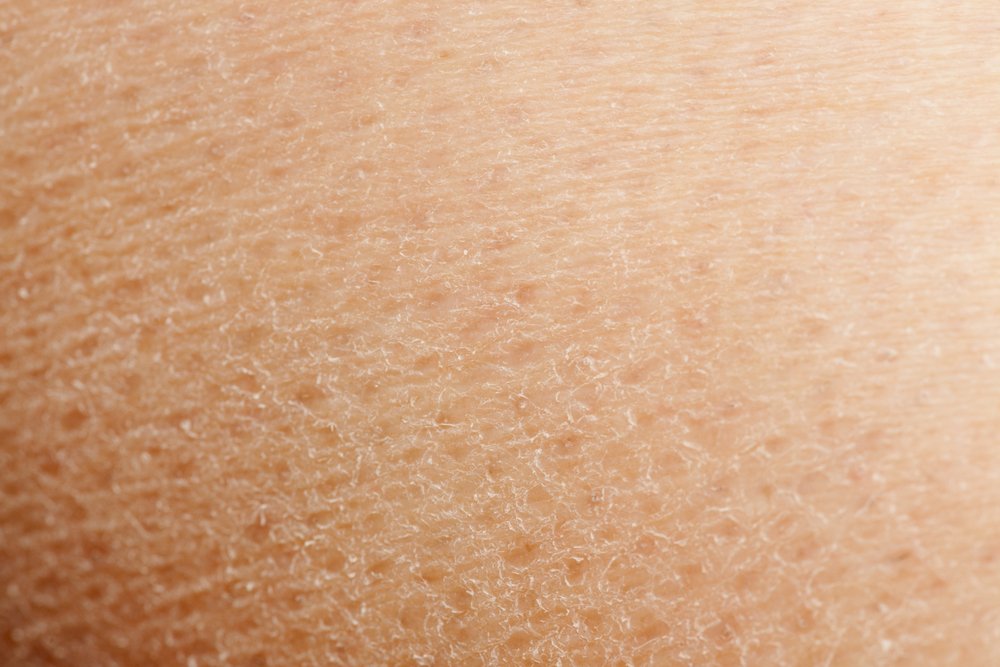 Un fondo macro-detallado de piel seca. | Foto: Shutterstock