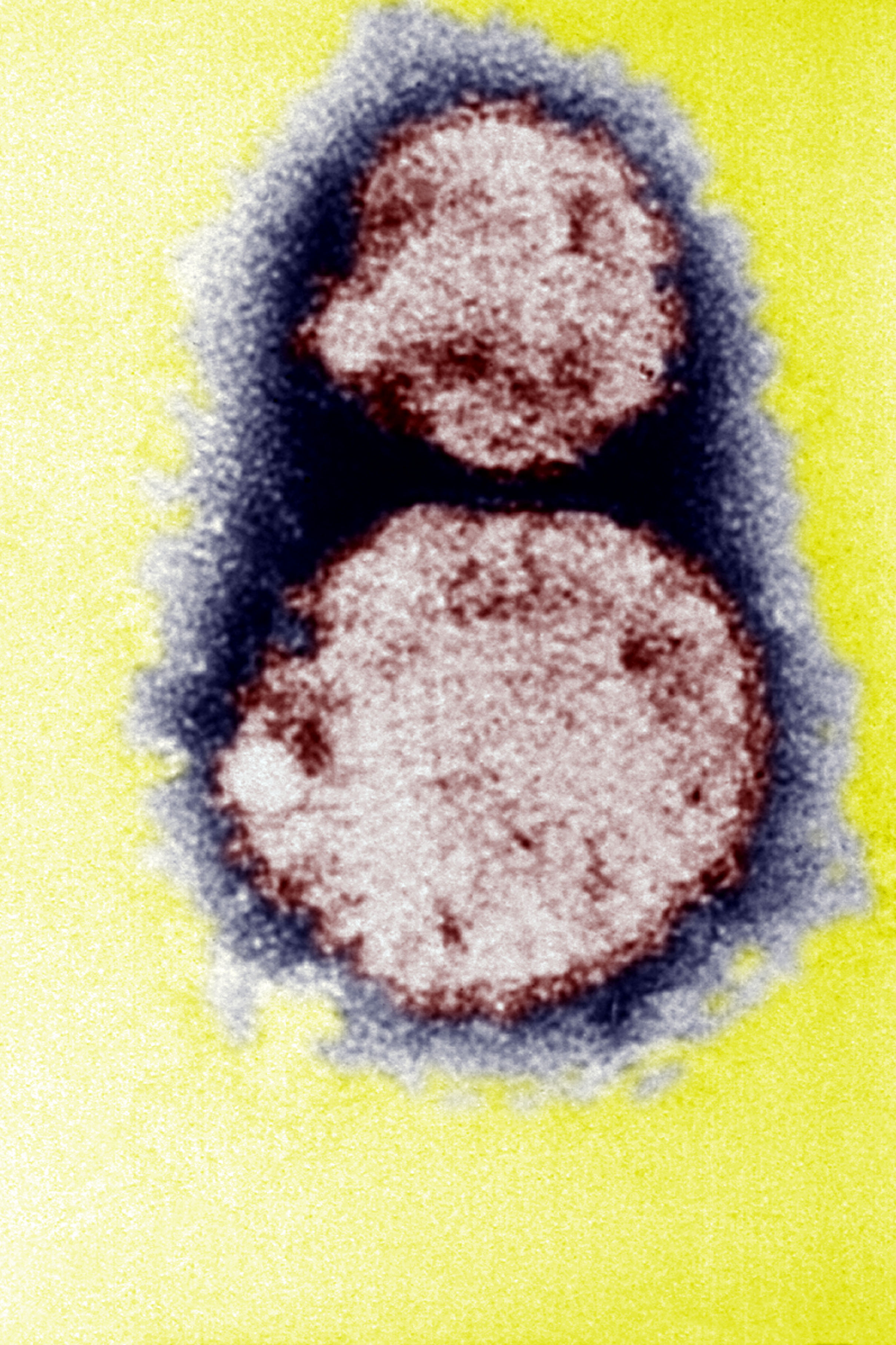 Hantavirus, agente causal del síndrome pulmonar por hantavirus (SPH). Esta micrografía electrónica muestra los viriones del hantavirus responsables de causar el síndrome pulmonar por hantavirus (SPH). | Fuente: Getty Images