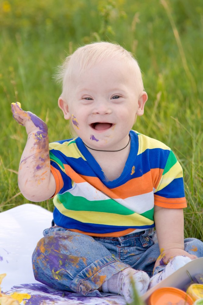 Bebé con síndrome de Down con pintura en las manos. Fuente: Shutterstock.